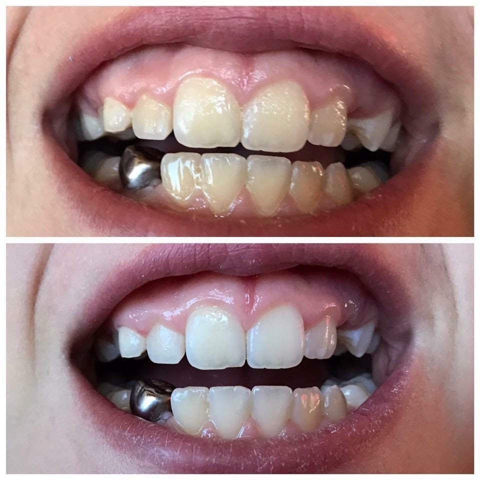 Kayla's Salon Whitening Toothpaste