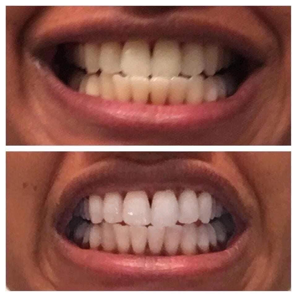 Kayla's Salon Whitening Toothpaste